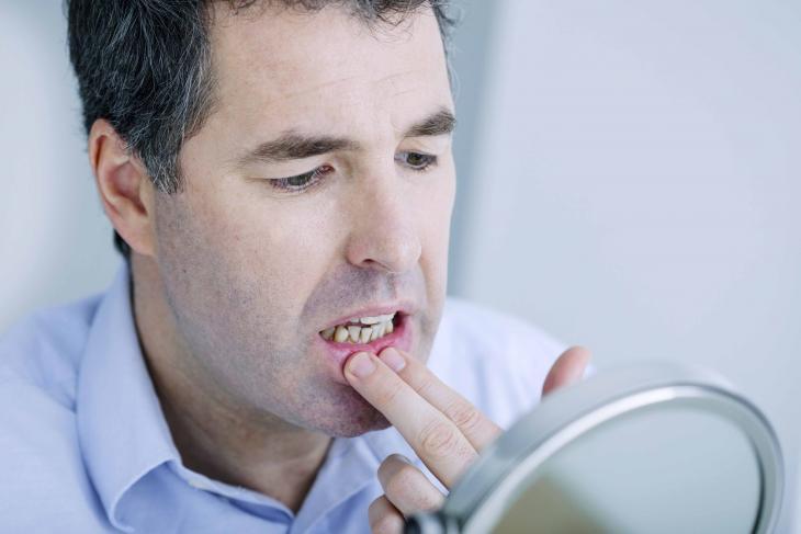 Imagem de um homem olhando os dentes em frente a um espelho